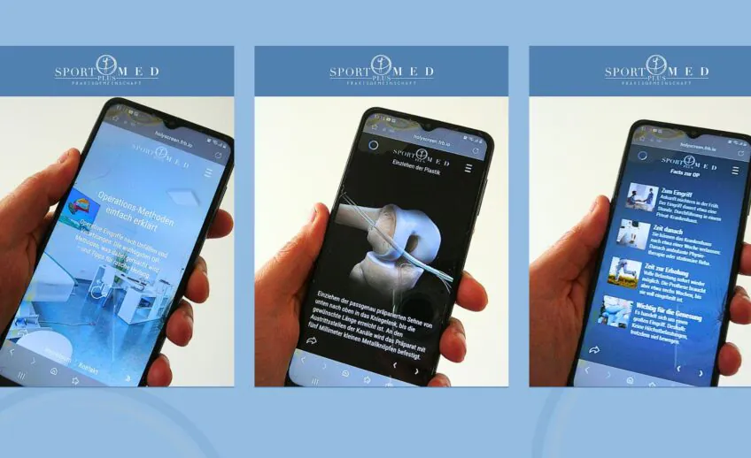 Operation-einfach-erklaert-Sportmed-Plus-1-848x518 Bild von Smartphones